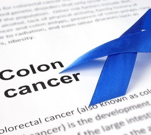 colon cancer screening