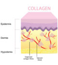 Collagen