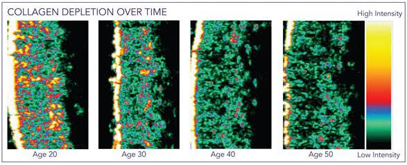 Can Collagen supplements reduce wrinkles? 