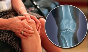 Joint Pain
